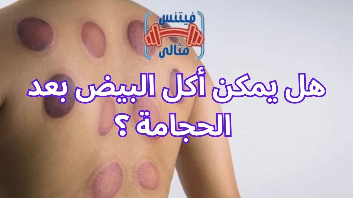 أفضل 5 مكملات غذائية لزيادة الوزن بسعر مناسب 2026 20 1 هل يمكن أكل البيض بعد الحجامة ؟
