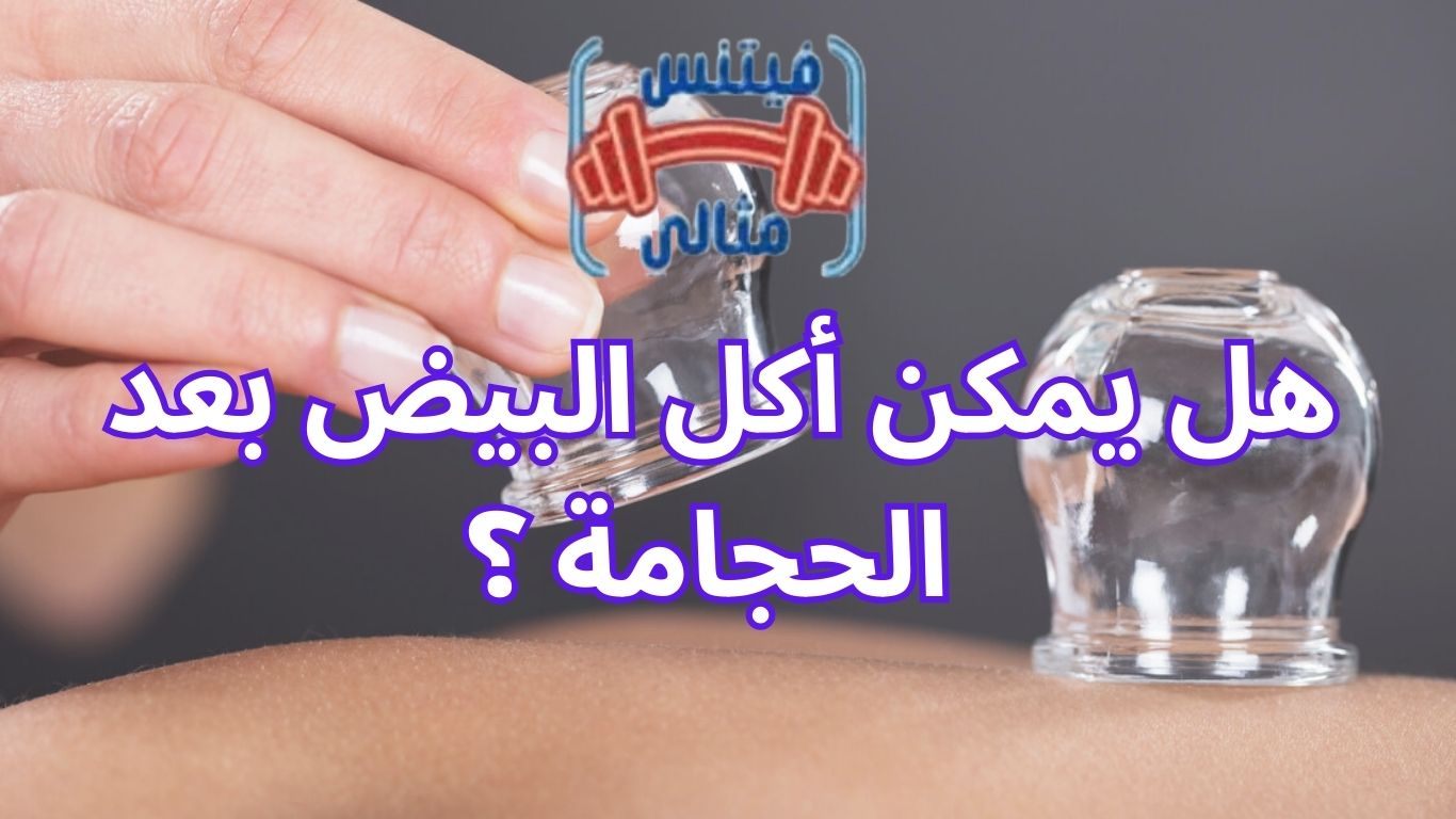 هل يمكن أكل البيض بعد الحجامة ؟ 
