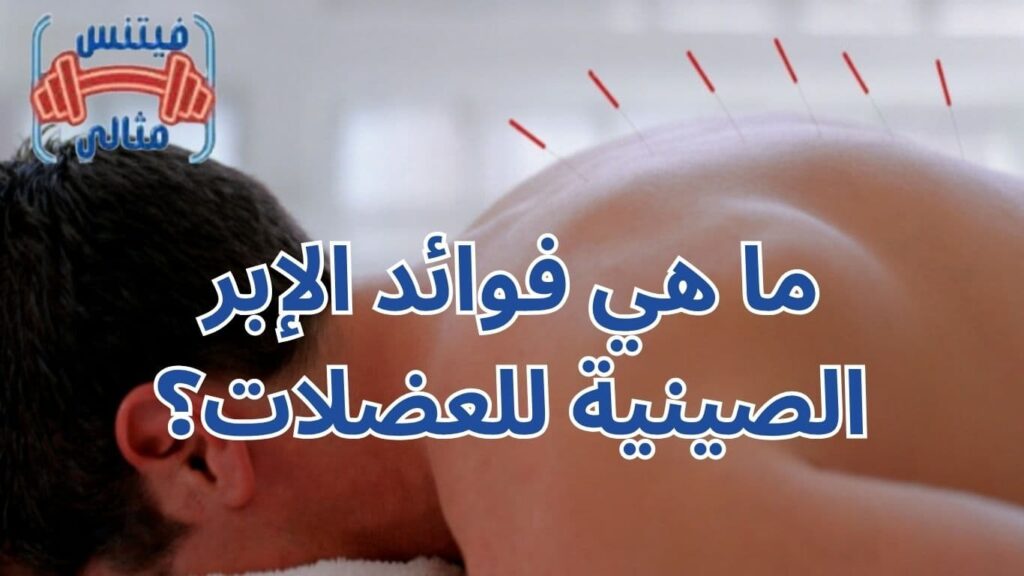 ما هي فوائد الإبر الصينية للعضلات؟