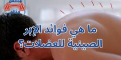 ما هي فوائد الإبر الصينية للعضلات؟